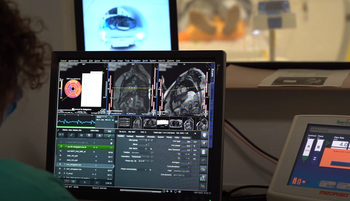 Artificial intelligence in use at Barts Heart Centre